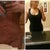 Right b4 weight gain and after sugery ..the effing same