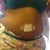 2-14-2013 tummy lipo