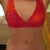 4 months post op. Looking very nice!!!