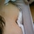 Few hours after surgery, inside look. They look yummy!!!!!!! hahaa