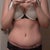 After tummy tuck...little bit of love handle fat I wanted removed