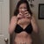 2 days after lipo