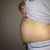 before tummy tuck nasty