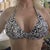 1 month post BA in bikini top