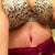 Day 7- My stretch marks were raised really bad due to swelling but they are finally going down