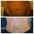Before/ 2 months