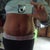 this is me ..10 days before surgery