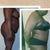before and after..different in 1 week apart..I'm 12 days post op..