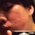 June 28, 2012 - Two months after procedure

This is the right side of my face (reflected in a mirror) given the worst possible lighting.