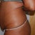 Physicians before pic side view