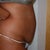 Physicians before pic
