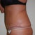4 months post op physicians pic