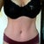 15 weeks post op