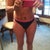 Even my upper tummy is bruised!!