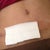 Pod 23 Incision line is really thin I'm happy about that. BB has Vaseline on it to keep it moist. I still have a few stretch marks not to bad. I 'm planning on getting a professional tattoo artist to tattoo over it later on when I'm fully healed. I'm look into some sexy tattoos ...I thinking of drawing my own tattoos since there aren't much out there I like.