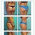 Dr. Salzhauer's work