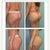 Dr. Salzhauer's work