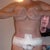 13 days po and feeling depressed about the fluid build up at the bottom of my tummy
