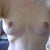 6 weeks post op  I think they are finally pretty even...and have gotten smaller...I think.  I am so happy.  Can't believe comparison of before/after...going to try to do a side by side!