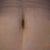 9 days post op Belly Button