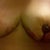 3 days after Breast Reduction