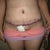 9 days post op.  they should be strippig the tape and glue next week so I can actally get everything washed of and see the incison