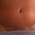 Scar at 4 months. No sign of those ugly spitting stitches.