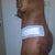 side view 4 days post op with a lot of swelling and bruising from Lipo