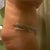still hunched over this is my less swollen side