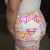 This is a side view of my sister at 8 days post op, mind u she still has a lot of swelling since she didnt have a drain and the drain is what helps u get rid of more fluids along with the whole of the back.