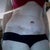 2 weeks after surgery