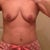 Before - front deflated and saggy