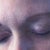 Hideous tattoos.  What a mistake!  Bad blepharoplasty, too--notice thick white stripes of skin on eyelids.