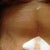 You can still see my old stretch marks.  I plan to tattoo my whole belly once im able too since i hate them . Sucks that doctor couldnt pull any more skin :(
