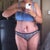 Front - three days post op