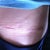left side of my scar after wearing ScarAway for 12 hours