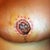 Left nipple 10days post op