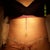 Day 8 Post Op.  Had the last 4 belly button sutures removed and the 2nd of 4 drains pulled.  This one hurt like the dickens but glad to have it out!