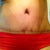 Close up of my scar and bb, still dark, but fading slowly. Using bio oil.