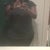 9 weeks Post Op Clothed