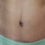 3 months post-op.