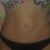 5 months post op close up of BB (thinking about getting a belly ring because that is the only thing I am not happy with..not a cute belly button!!