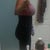 Side vew after bbl and tt 1 week post op