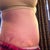 11 weeks po, swell hell is still here