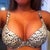 post op day 5... 32D so far :D