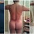 1st pic is before bbl, 2nd pic is a year after 1st bbl and 3rd pic is a day after 2nd bbl.