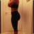 With pants 7 months post-op