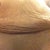 Close up of c-section area