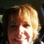 Just goes to show how much sun you get on your face in the car - BUT I do have on SPF 50 sunblock! Day 18(?) post-Fraxel repair (1/30/12) Most of swelling is gone - still a little red and itchy at times. I see my doctor again on 2/6/12.