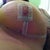 Day 8 post OP under view